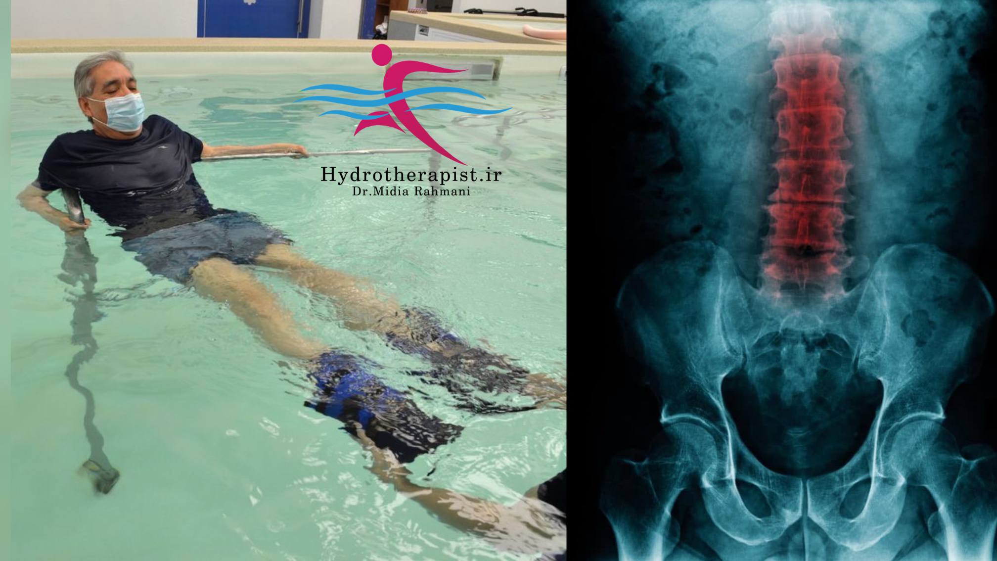 تاثیر آب‌درمانی بر کاهش درد و بهبود عملکرد در بیماران مبتلا به دیسک کمر: یک مطالعه مقایسه‌ای بین گروه کنترل و تجربی